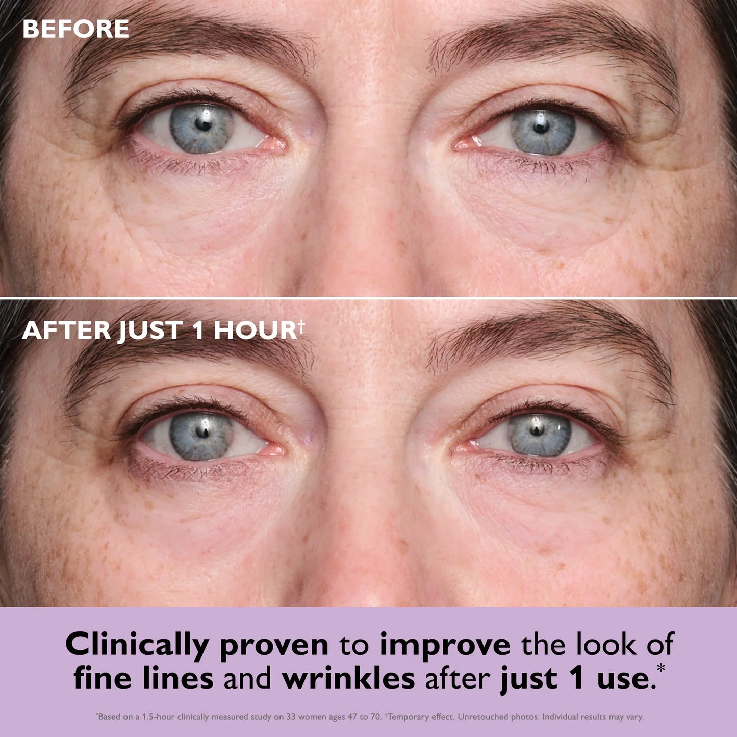 Kit Collagen Eye Patches