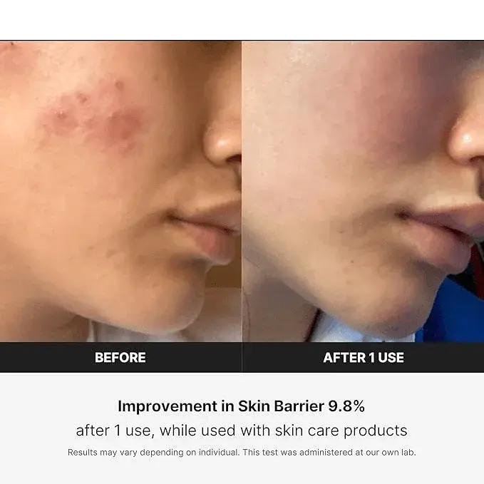 BOOSTER PRO: THE ANTI-AGING 6 in 1 SKIN REVITALIZER YOU DESERVE - Divine Beauty