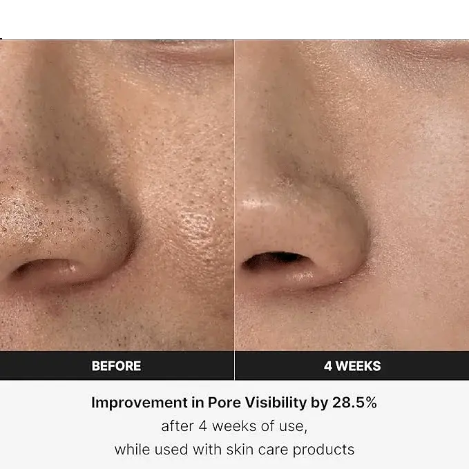 BOOSTER PRO: THE ANTI-AGING 6 in 1 SKIN REVITALIZER YOU DESERVE - Divine Beauty