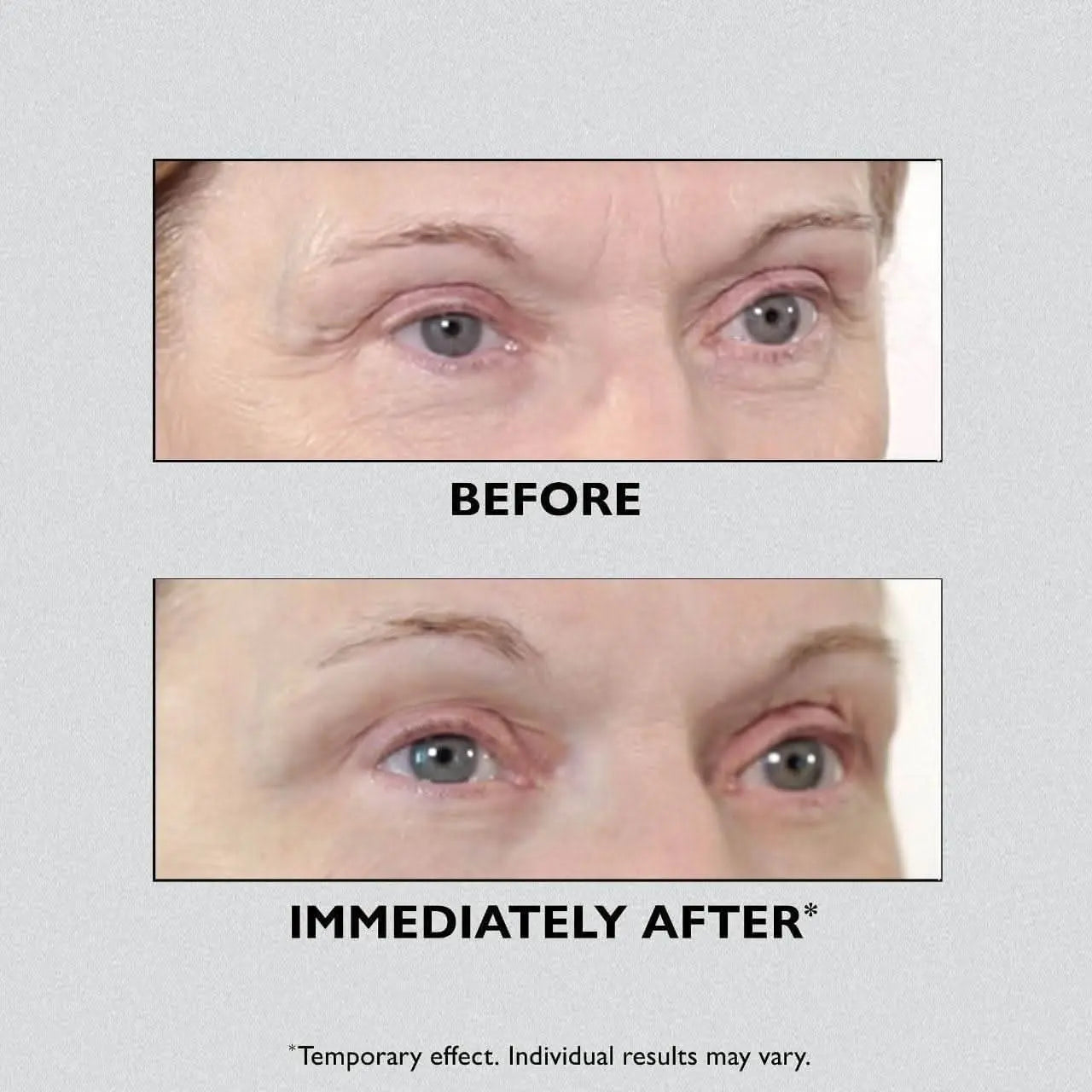 ✨ Instant FirmX Eye – Instant Lifting Without Needles! ✨ - Divine Beauty