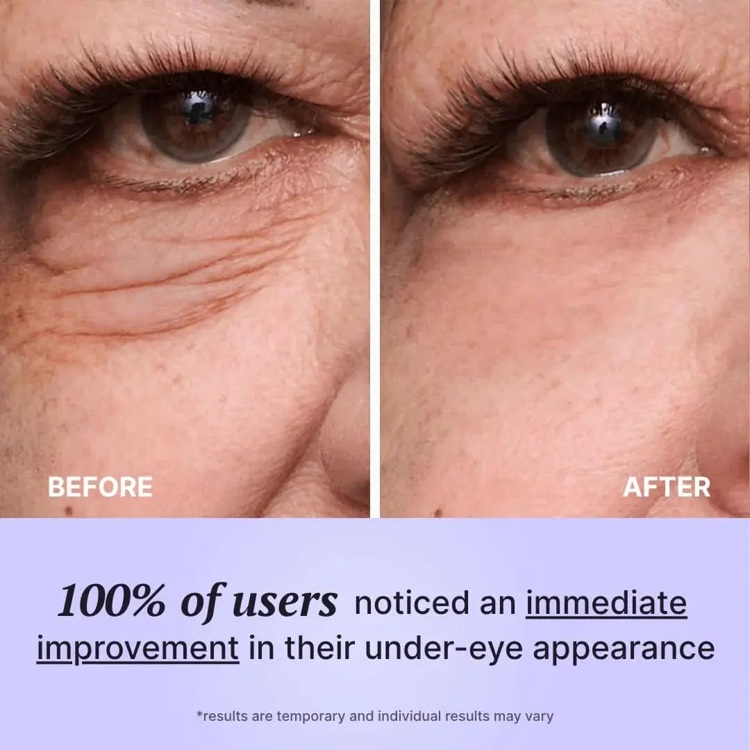 Perfect FirmX Eyes – 60s Eye Tightener - Divine Beauty