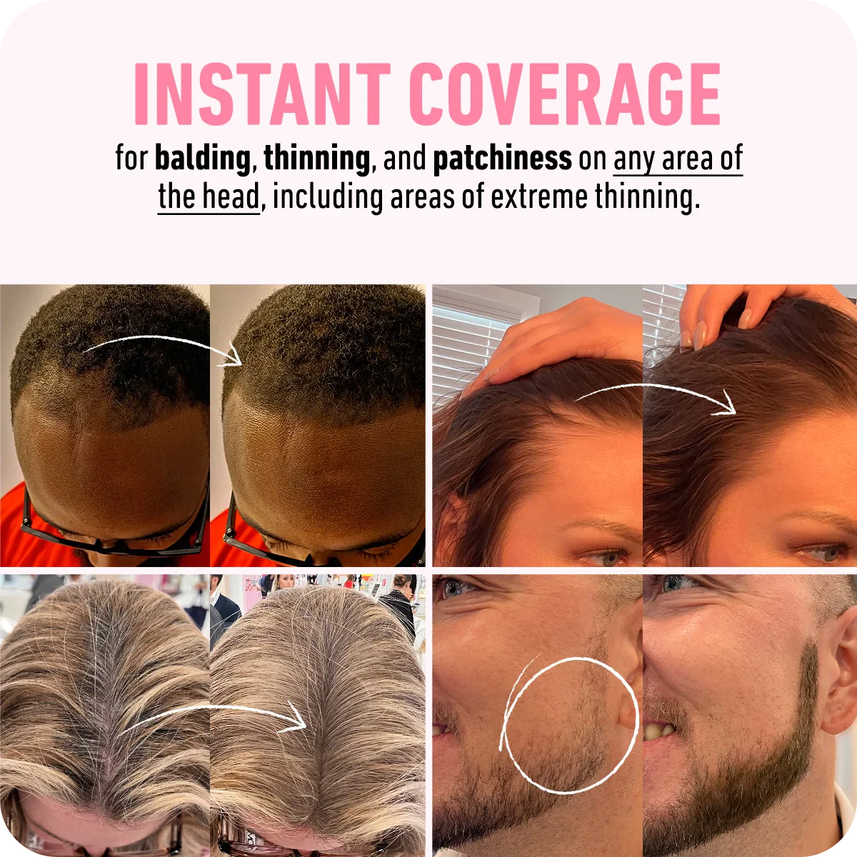 Magic Hair - Direct resultaat