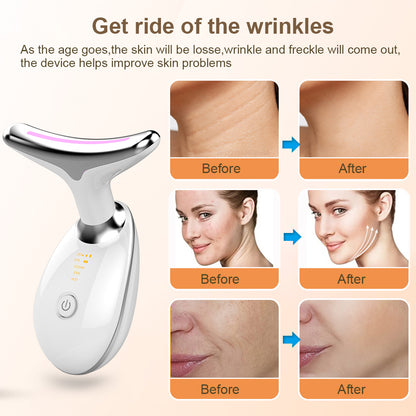 FaceLift - Renew your skin and revitalize your beauty with the Phototherapy Massager.