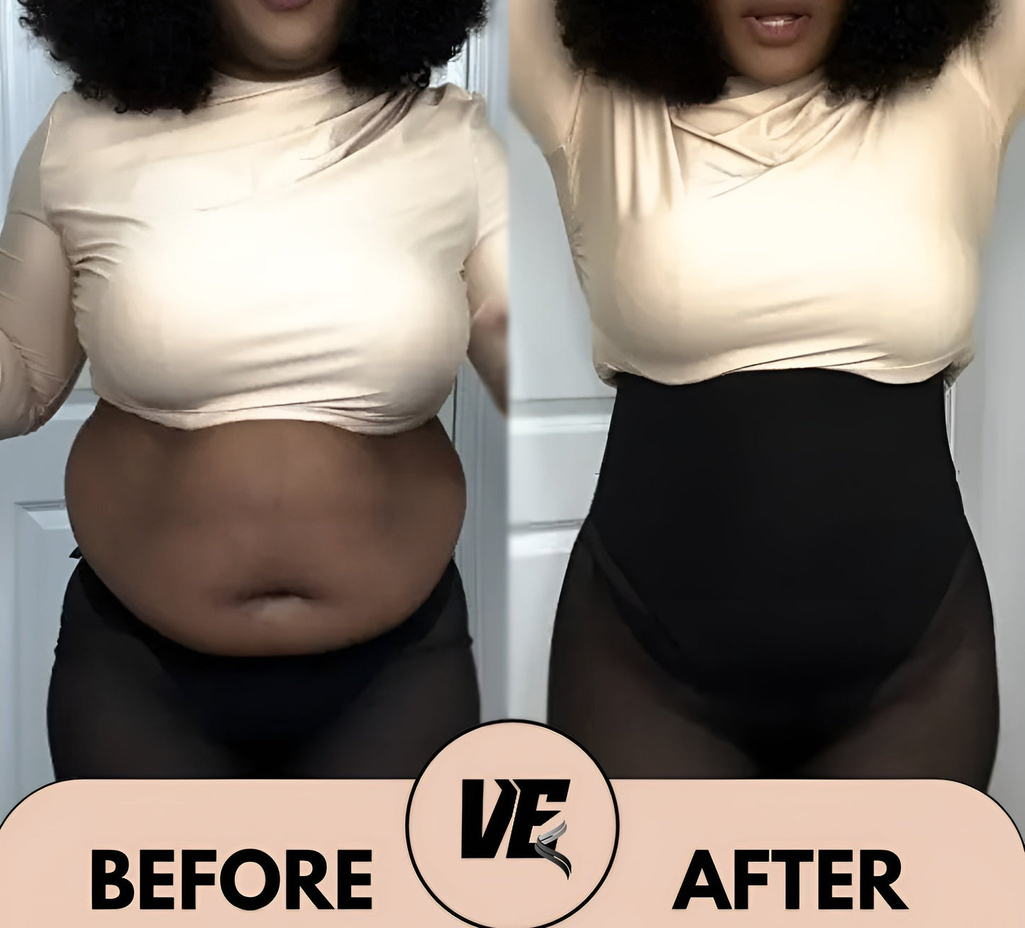 BellaShape® – Transformeer je rondingen. Ontketen je zelfvertrouwen. 