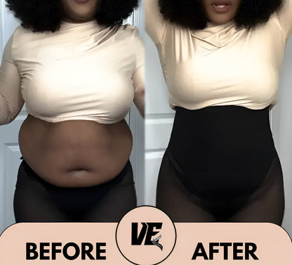BellaShape® – Transformeer je rondingen. Ontketen je zelfvertrouwen. 