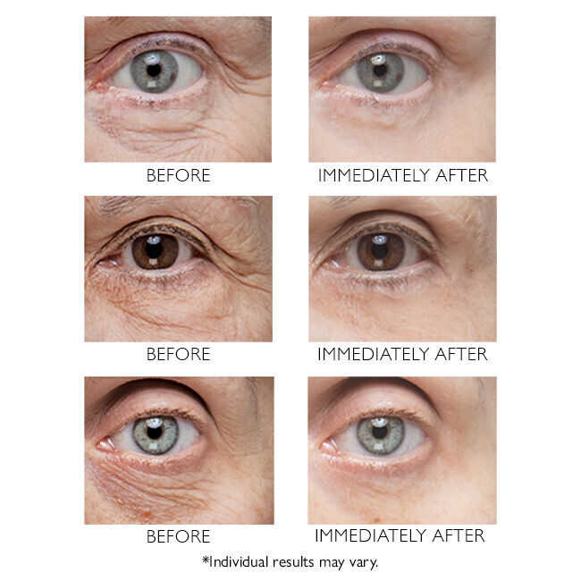 ✨ Instant FirmX Eye – Instant Lifting Without Needles! ✨