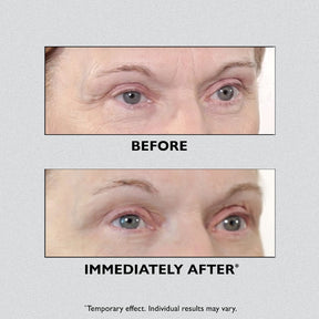 ✨ Instant FirmX Eye – Instant Lifting Without Needles! ✨