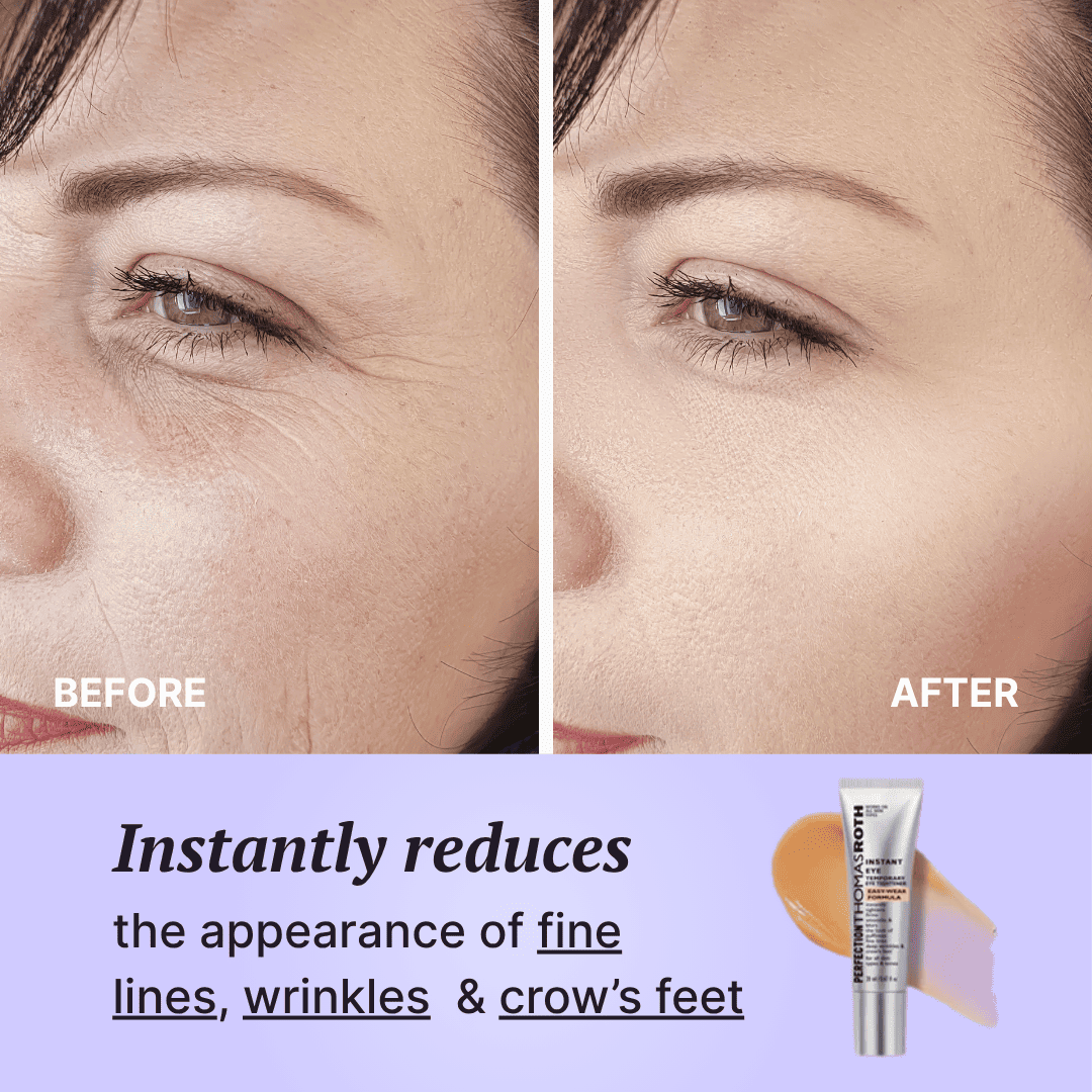 Perfect FirmX Eyes – 60s Eye Tightener