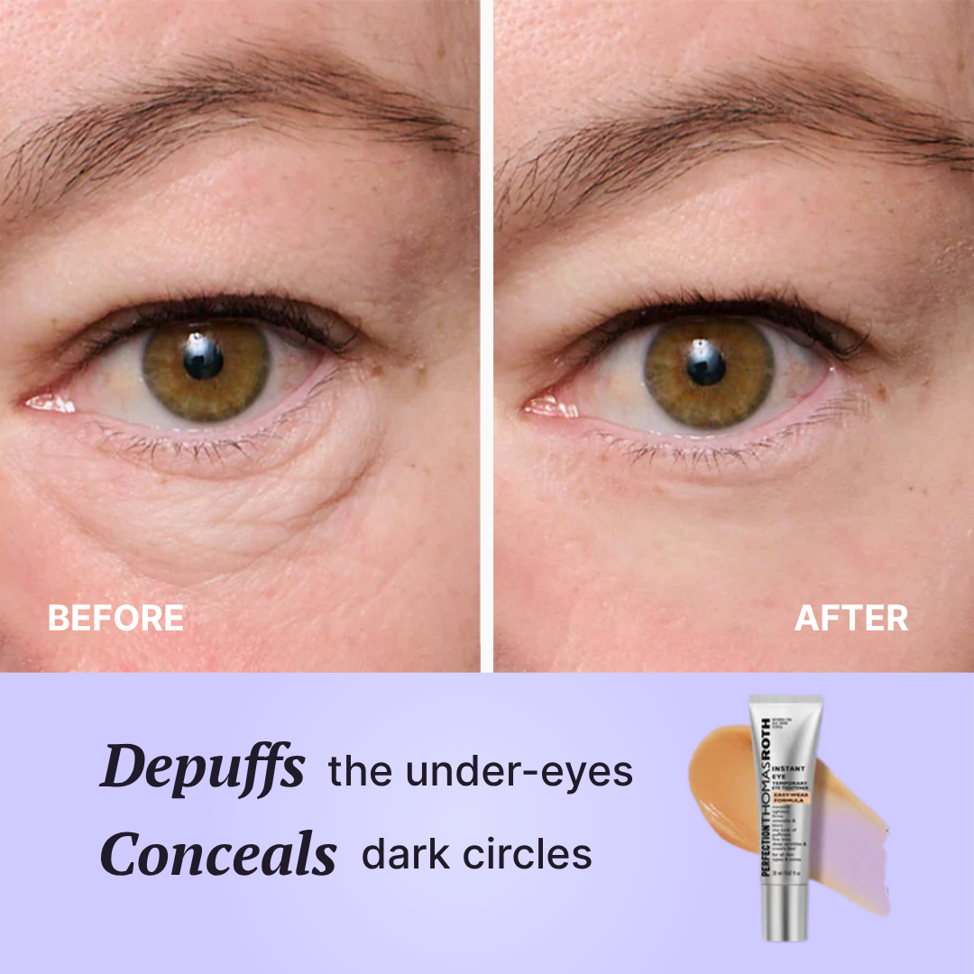 Perfect FirmX Eyes – 60s Eye Tightener