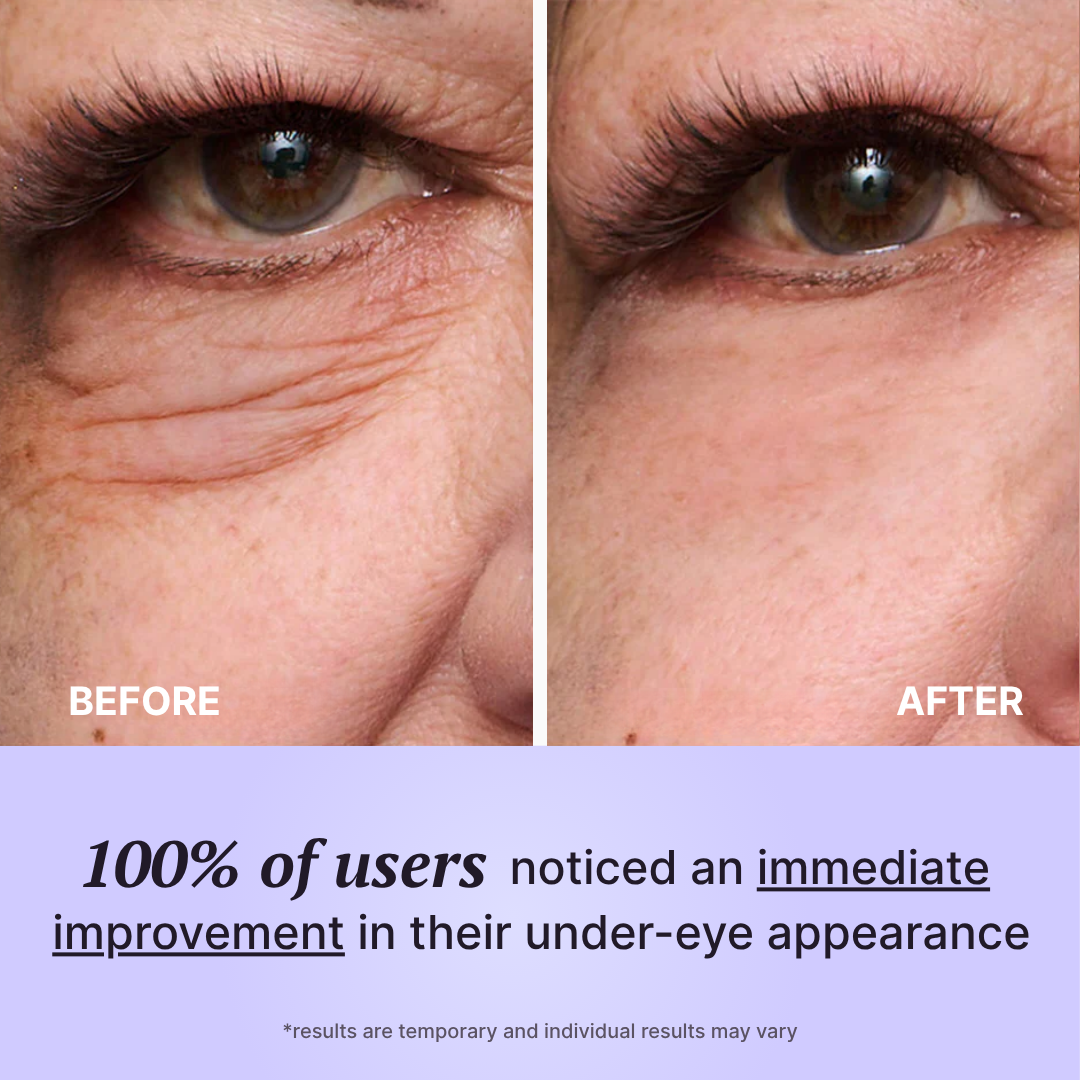 Perfect FirmX Eyes – 60s Eye Tightener