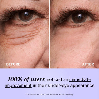Perfect FirmX Eyes – 60s Eye Tightener - Divine Beauty